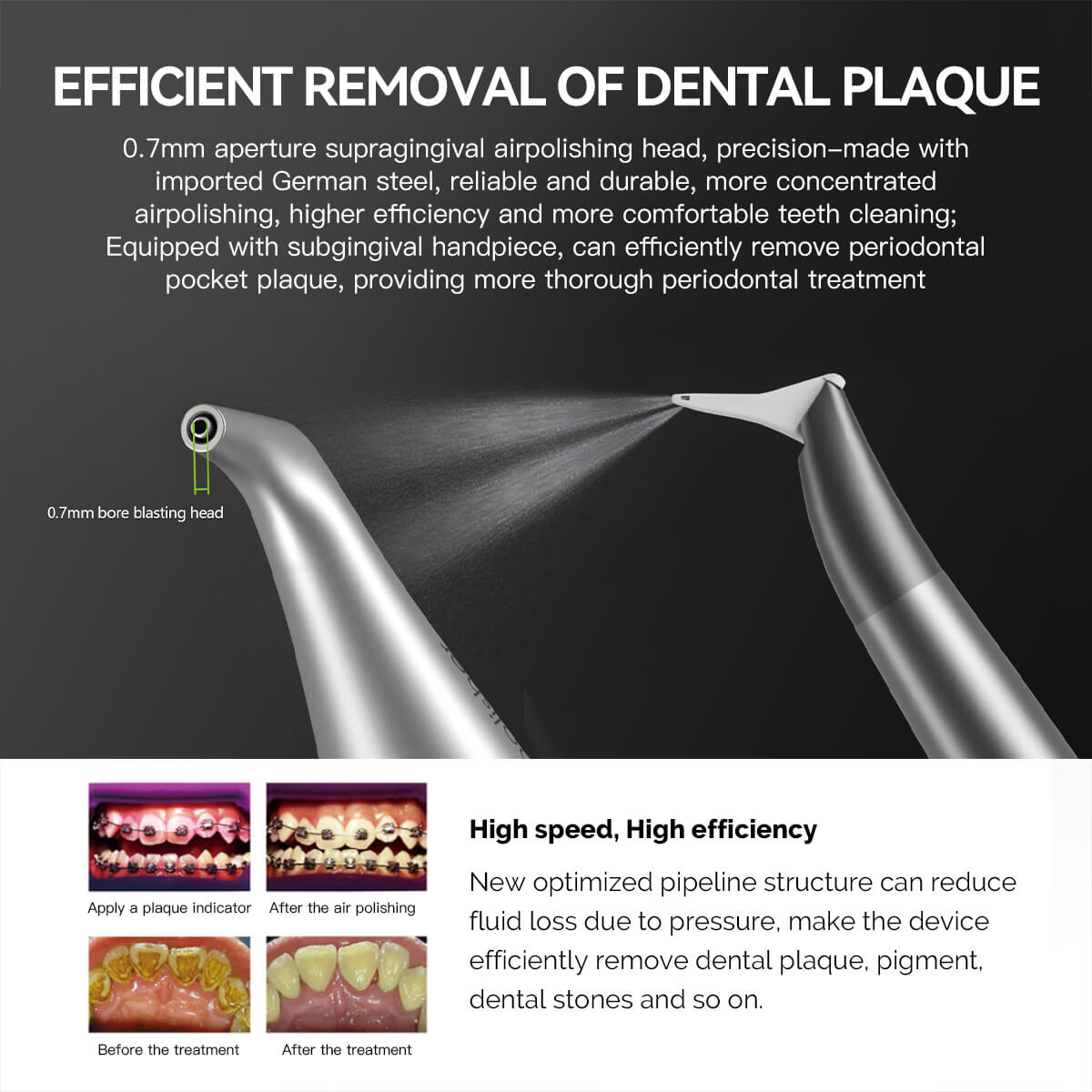 Dental Air Polisher Nozzles Gingival & Subgingival Sandblasting Handle for EMS AIR-FLOW