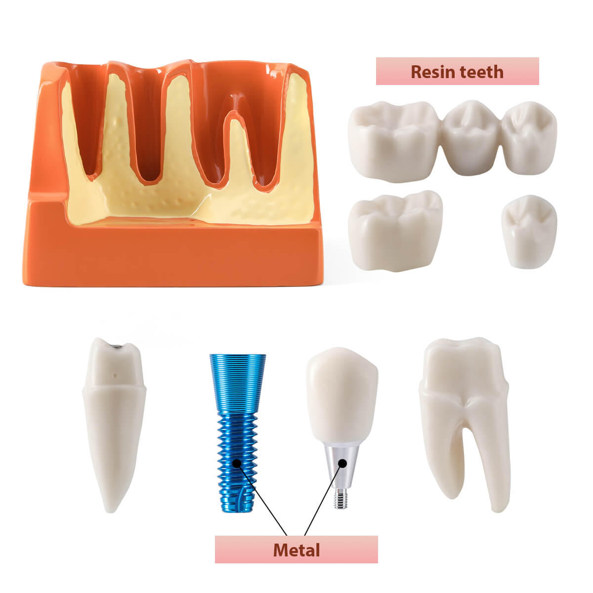 Dental 4 Times Implant Teeth Model Analysis Crown Bridge Demonstration Removable