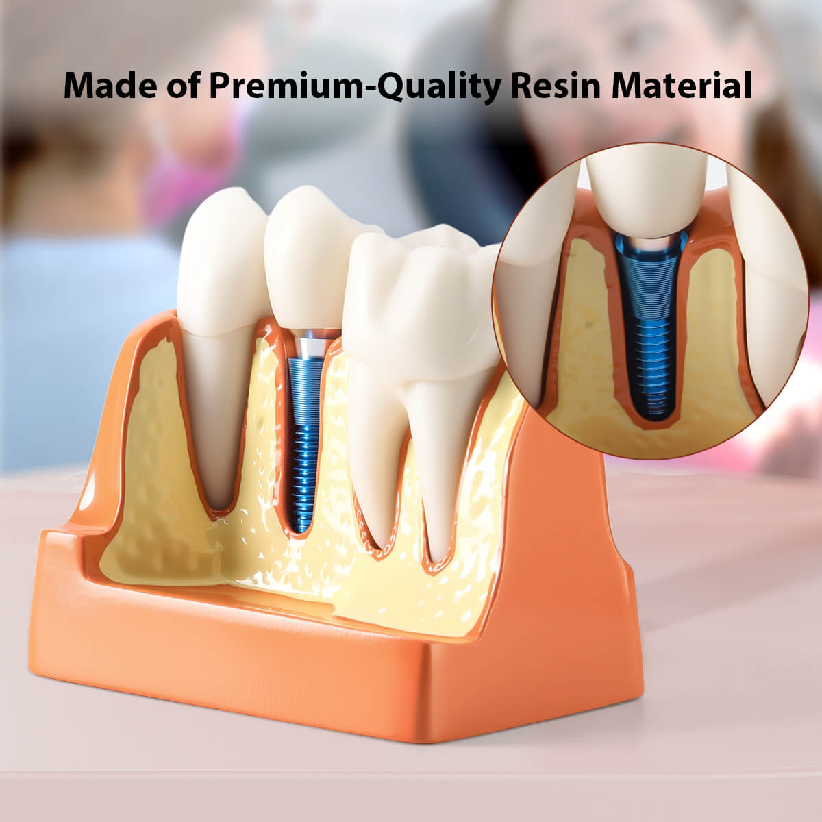 Dental 4 Times Implant Teeth Model Analysis Crown Bridge Demonstration Removable