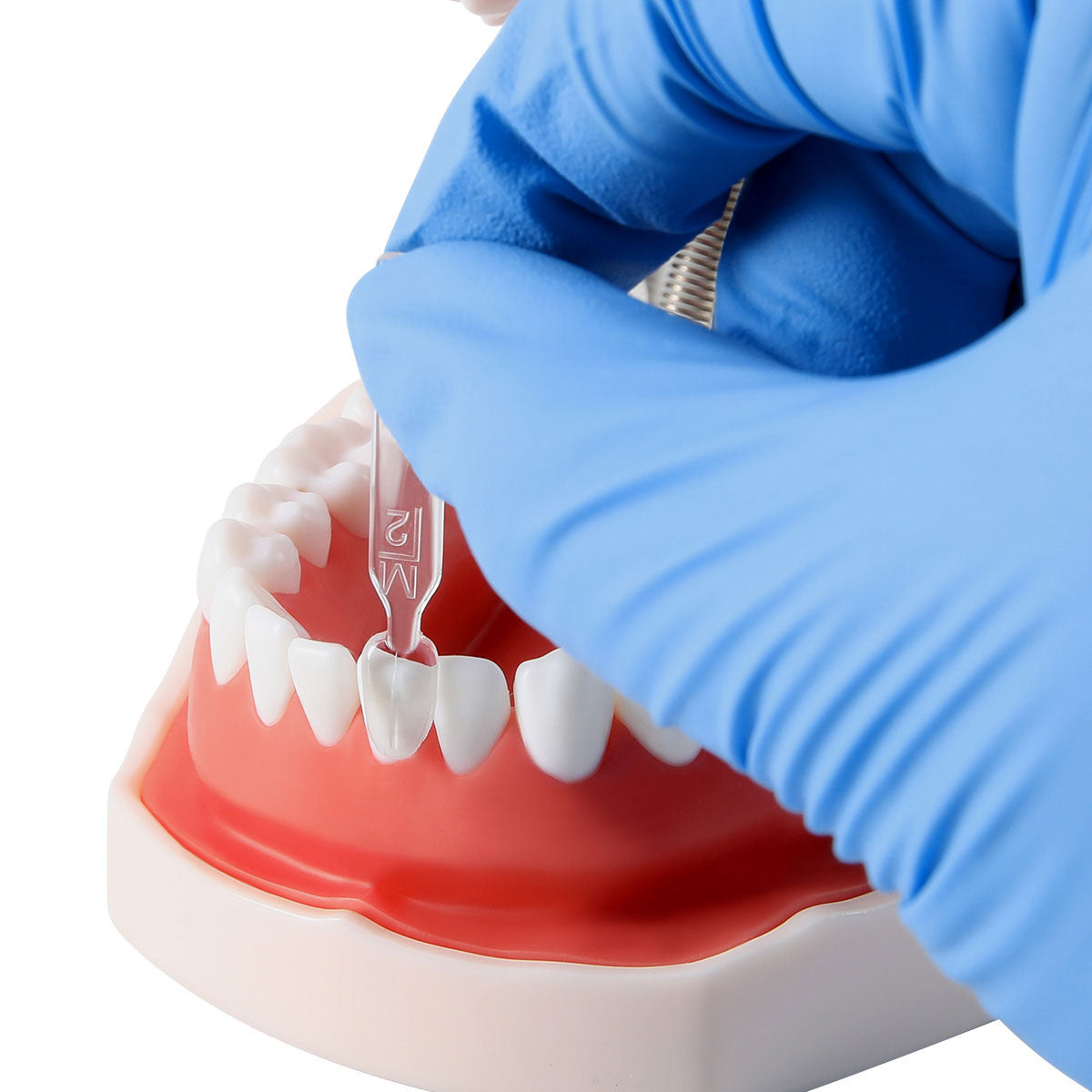 Dental Veneer Mould Kit Light Cure Composite Resin Teeth Fast Whitening Tools Autoclave 32pcs/Kit