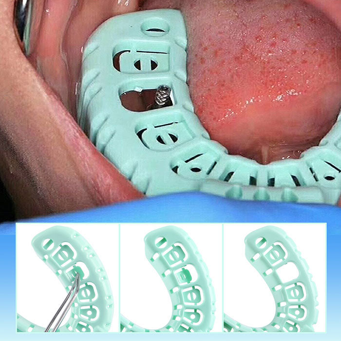 Bandejas de impresión dental de boca completa para moldes dentales, tamaño pequeño, verde, 6 piezas/juego