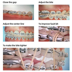 Orthodontic Elastics Rubber Bands Latex Braces Force 5.0 Oz 5000pcs/Box