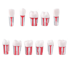 Dental Endo Teeth Model Transparent Root Canal Practice Block RCT Pulp Cavity Study Training Teaching 5Pcs/Set