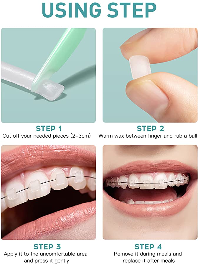 5 Boxes AZDENT Orthodontic Wax Scented Assorted 5 Strips/Box