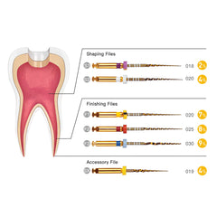 AZDENT Dental NiTi Rotary Engine Files 25mm Assorted SX-F3 Gold 6pcs/Pk