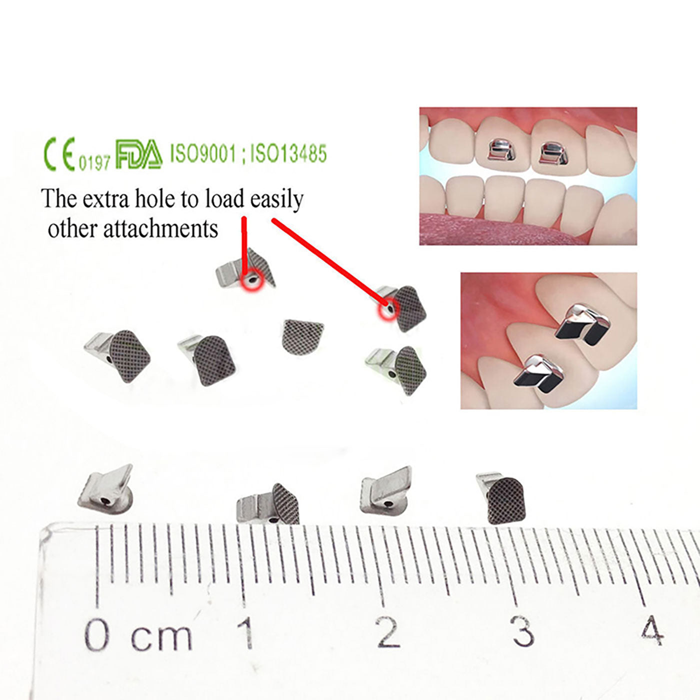 AZDENT Bite Turbos Arco de Ortodoncia Tubo Bucal Banda Molar 10/Bolsa