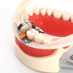 Пластиковый клин для межзубных промежутков Dental Prime Teeth с защитой, стоматологическая стальная матрица, средний оранжевый, 50 шт. в коробке