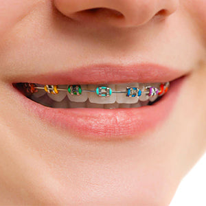 AZDENT Orthodontic Ligature Ties Multi-Color & Clear Color 1014 pcs/pack